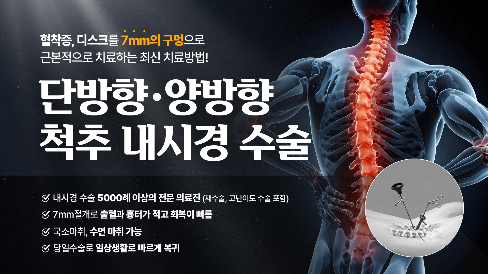 서울센트럴병원
척추 내시경 수술