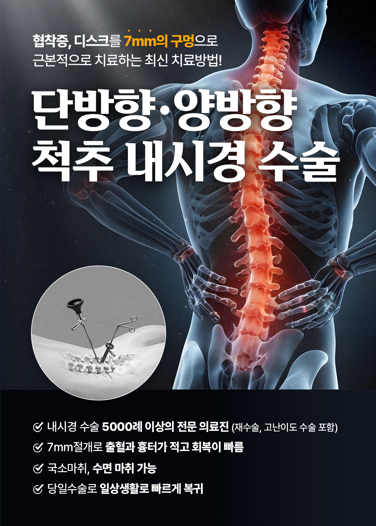 양방향 · 단방향
척추 내시경 수술